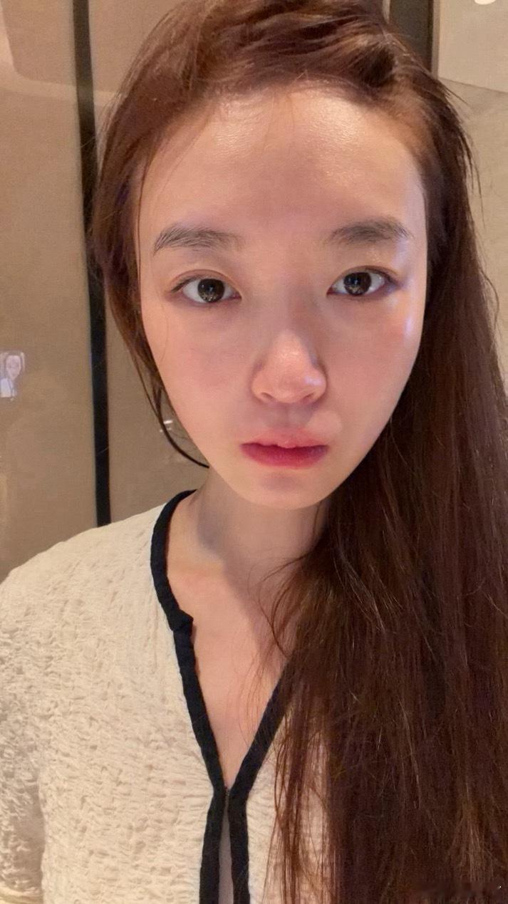 宝哥给我做完三个项目后，不但脸变小了黑眼圈都变淡了！最近皮肤已经完全是婴儿 ​​