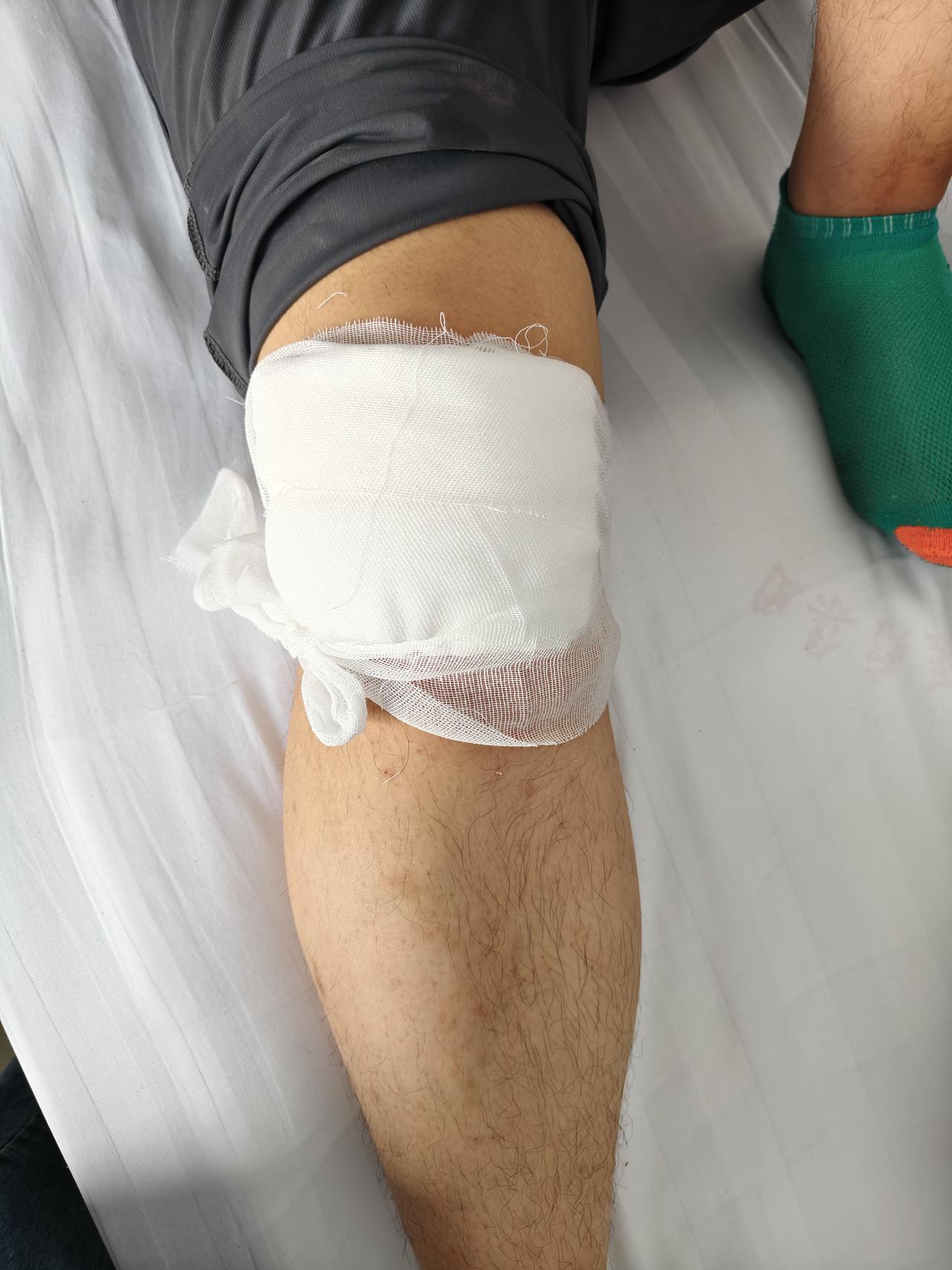 儿子不小心将右膝盖受伤，住进了运城盐湖医院🏥，我跟他爸两个人轮流着照顾他，每天
