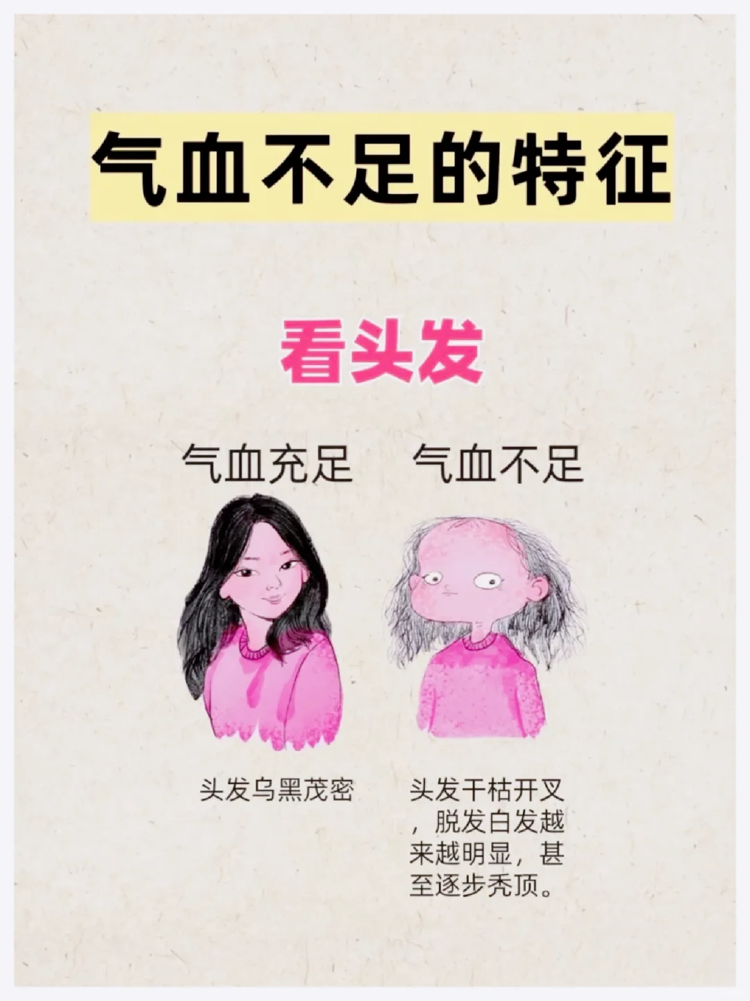 六个气血不足的特征，你都🀄了吗？