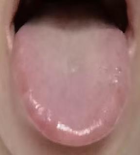 精关难以稳固，当心心气不足夹杂湿热肾虚






有粉丝和我倾诉，早年没有把握