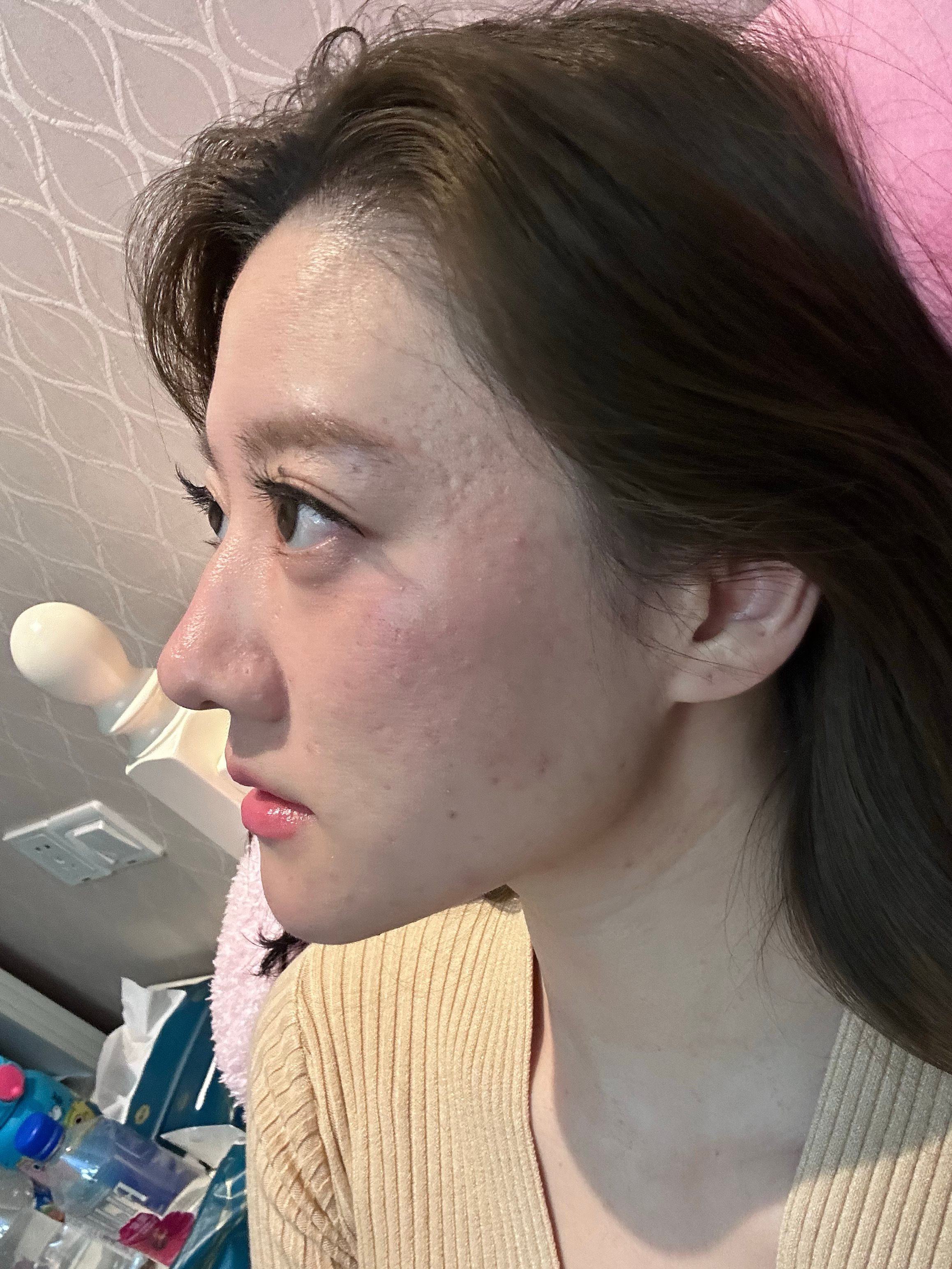 油痘毛孔肌不要涂高光（一般毛孔都在脸颊处） 在颧骨的位置  会显得毛孔更明显了 