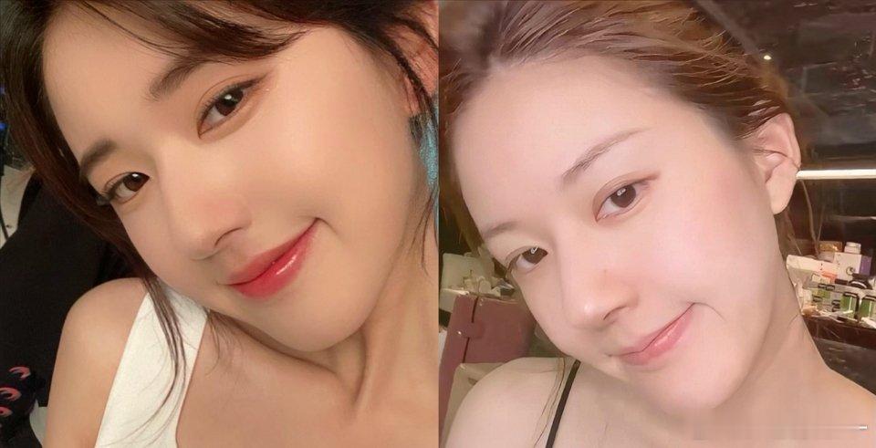 赵露思素颜状态五官变了吗？ ​​​