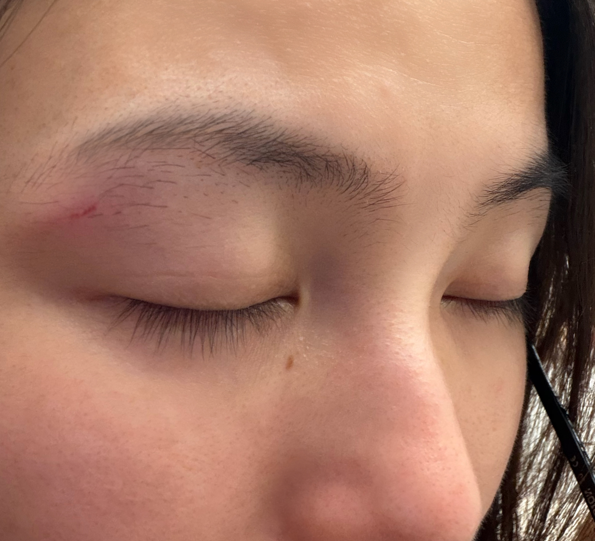 每天不是磕到这里就是碰到那里这下好了