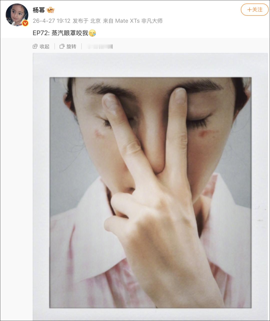 4种情况不要用蒸汽眼罩【蒸汽眼罩是不是智商税？】有些商家宣称“戴蒸汽眼罩睡觉可护