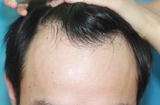 人到中年，分享一些人性“潜规则”。
1.靠吃伟哥助兴的男人不能要。
2.对熟人要
