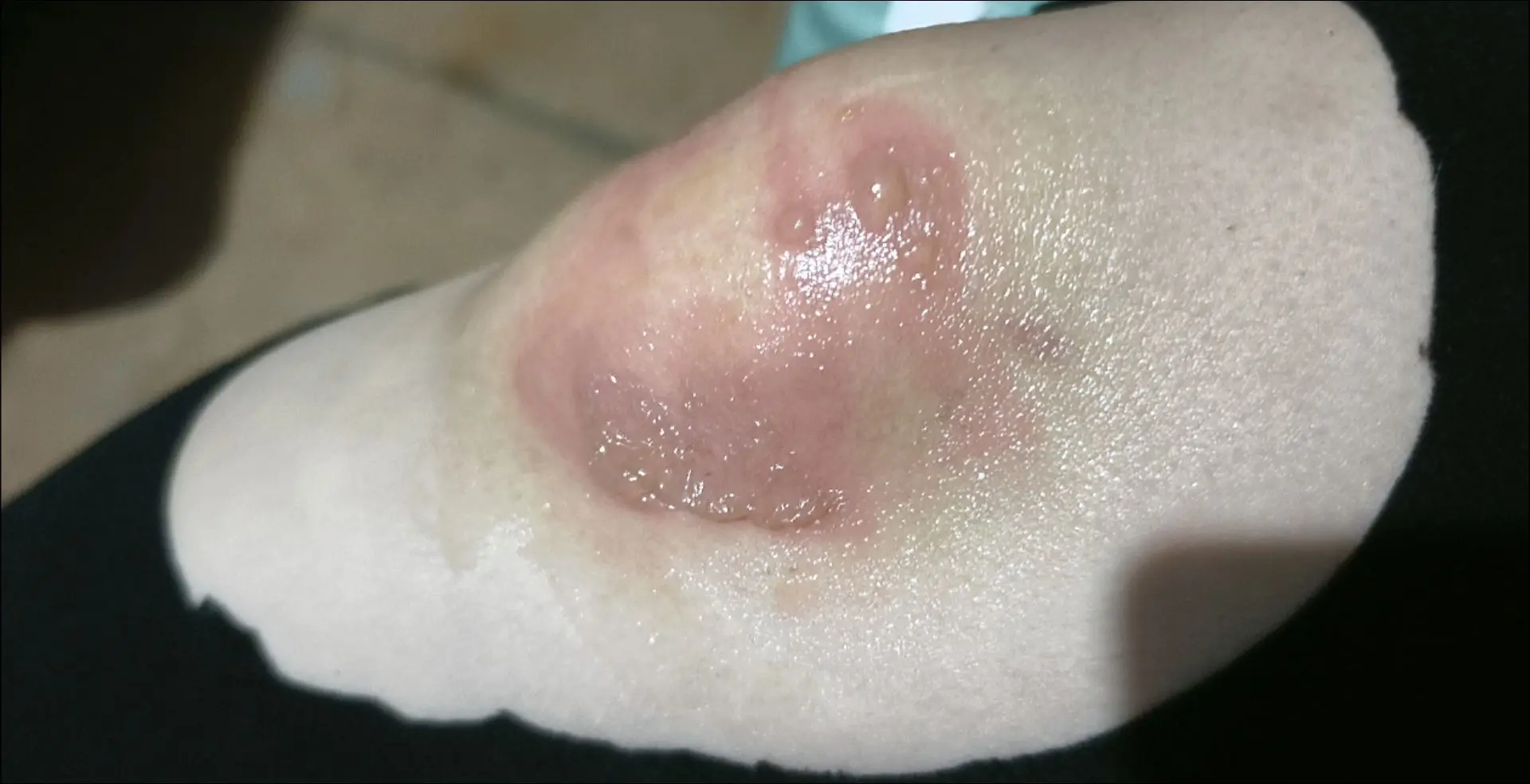 没有一口吃的时我没哭，没有地方住时我没哭，没有钱时我没哭，但是被关心暖...