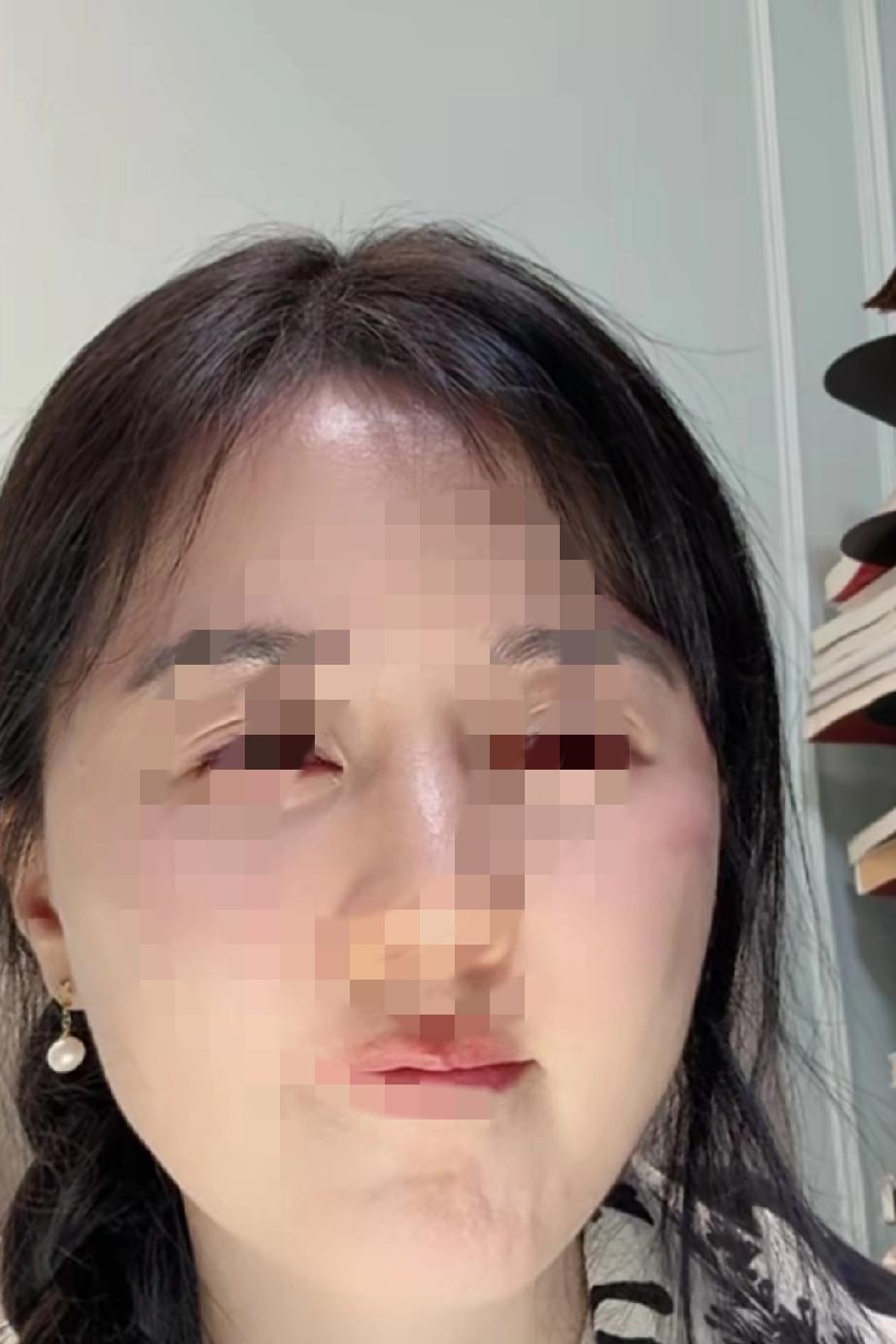 相宜博士遇冷了，昨天直播间哭了又哭，非常伤心，伤感自己走来的不容易。本来在视频号