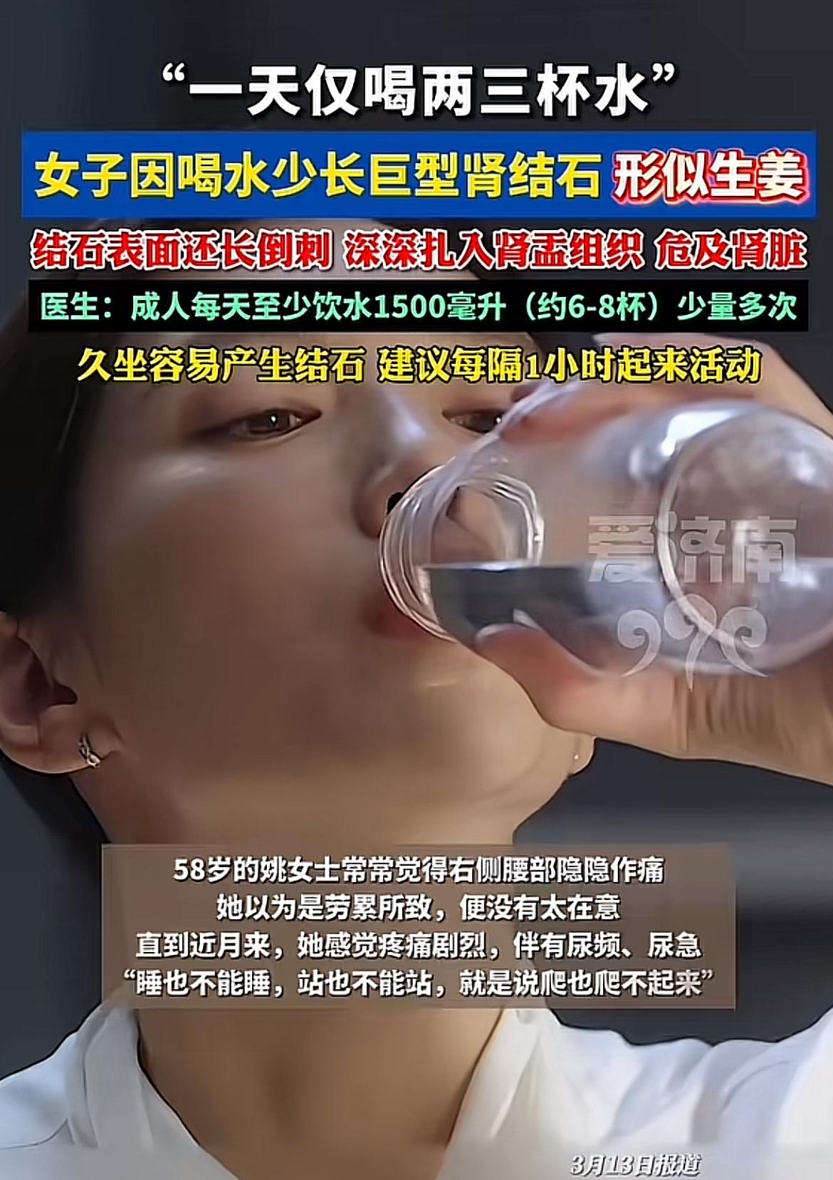 扬州58岁的姚女士可太惨了，就因为喝水少，长出了巨型肾结石！她平时一天就喝两三杯