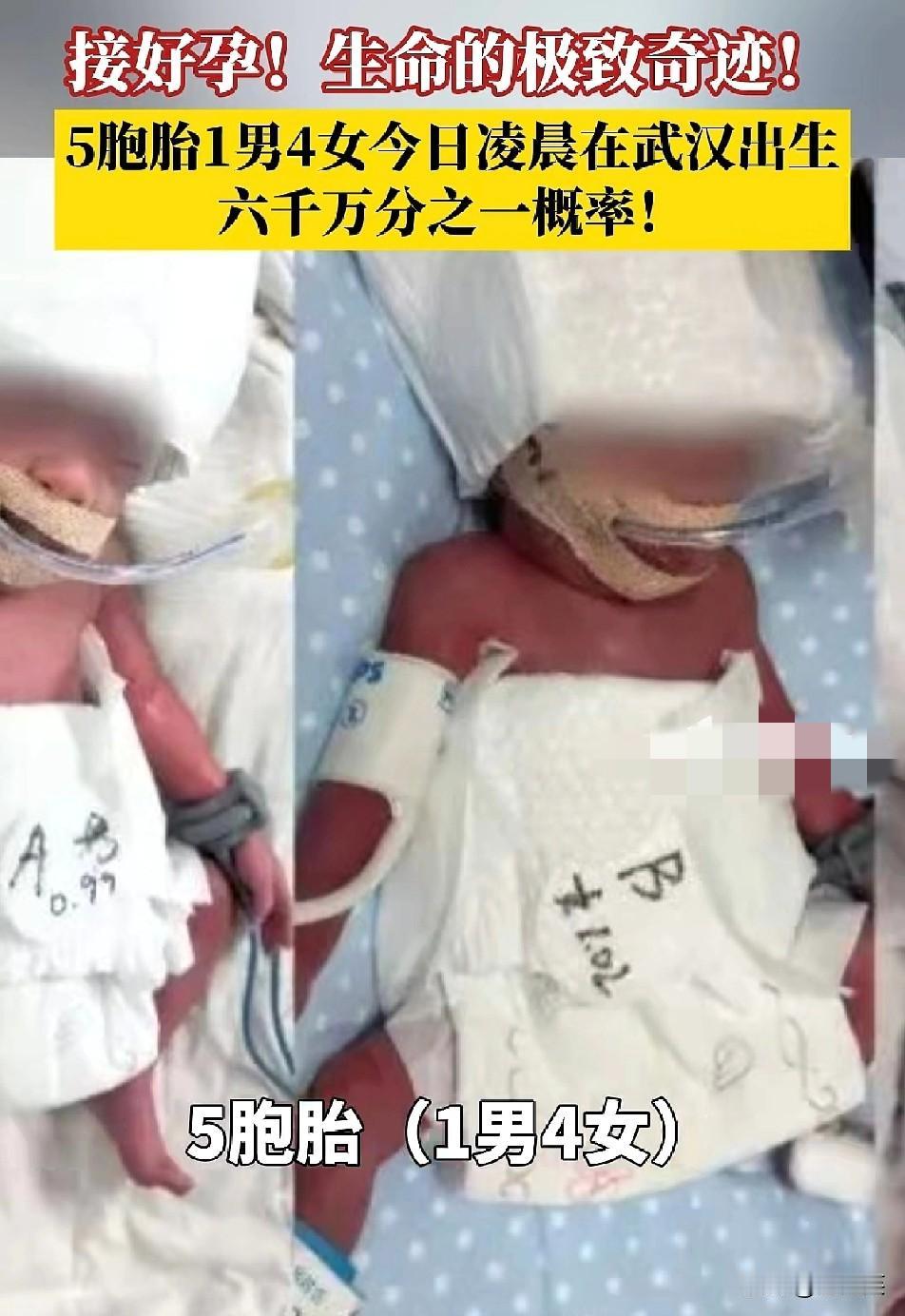 一位来自新疆的妈妈

在武汉成功诞下1男4女五胞胎

这是全球自然受孕中，概率仅