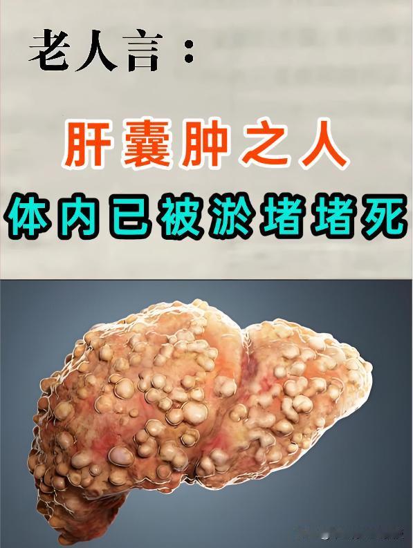 肝囊肿，多是痰瘀在作怪！一剂古方，化痰瘀、消囊肿
肝囊肿，看似只是肝脏上长了个“