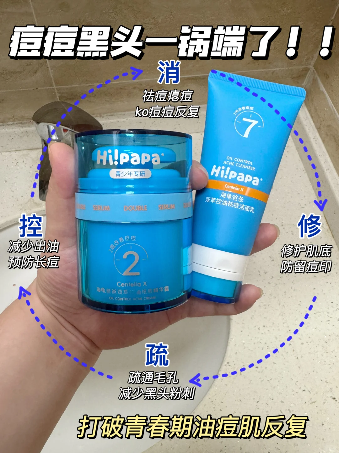 祛痘牛！青春期细皮嫩肉组合！用一次夸一次
