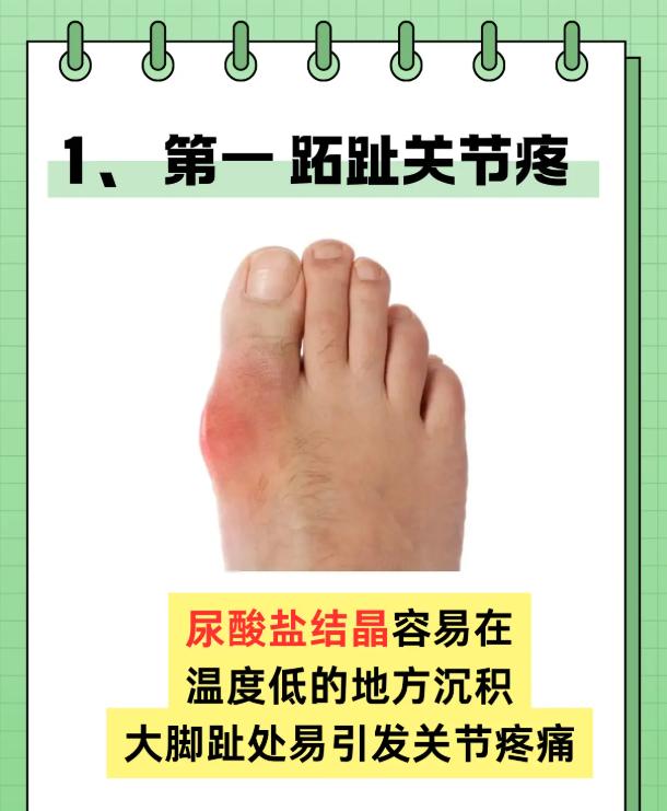 五大预警表现，及时发现高尿酸潜在问题