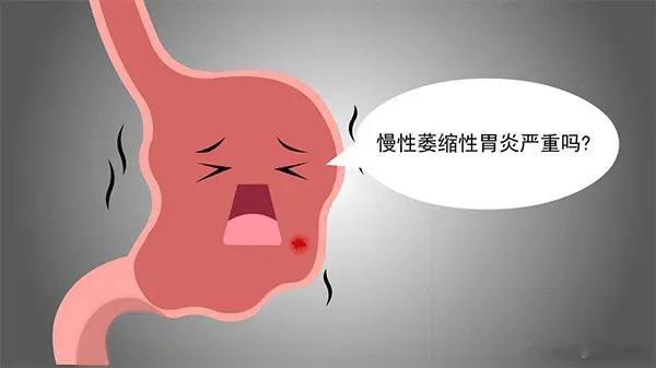 治疗慢性萎缩性胃炎，这4个西药，4个中成药，您一定要知道：一、西药：1、艾司奥美