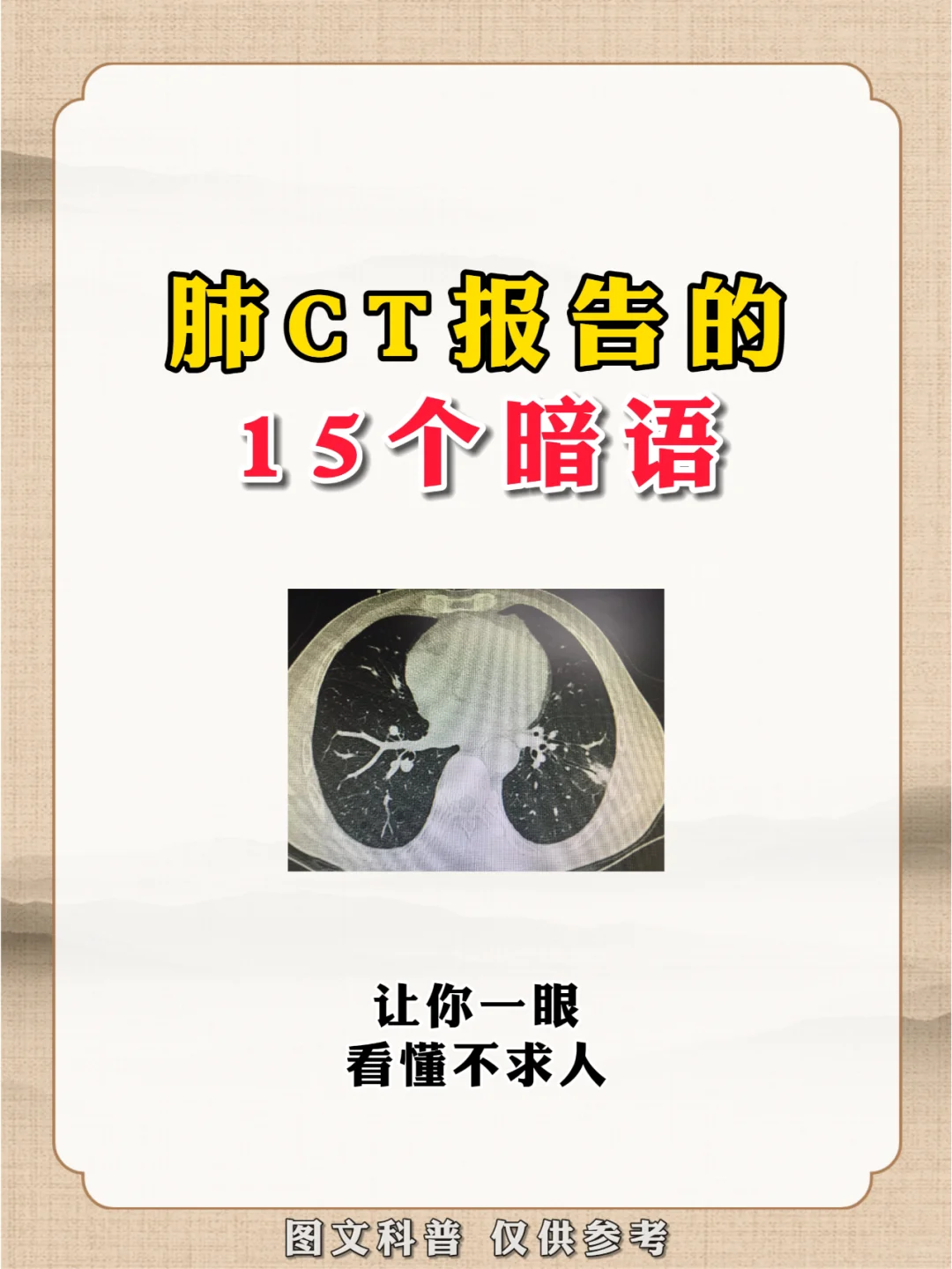 肺CT报告15条“暗语”，出现这些字眼别大意