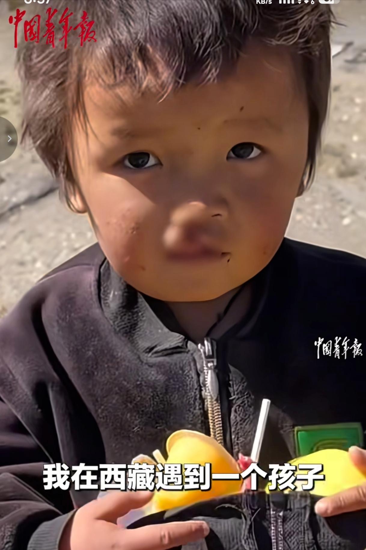 “积大德了!” 西藏日喀则，一名女子去旅行时，偶遇一位唇腭裂严重的男孩，他安静站