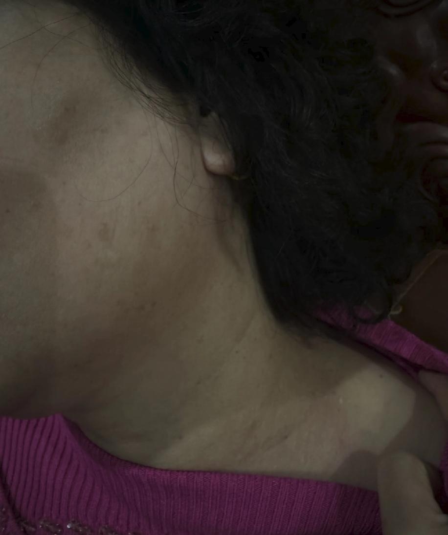 妈妈身上莫名瘙痒已经很久了，没有任何明显症状，去查了血常规也没发现问题。一开始只