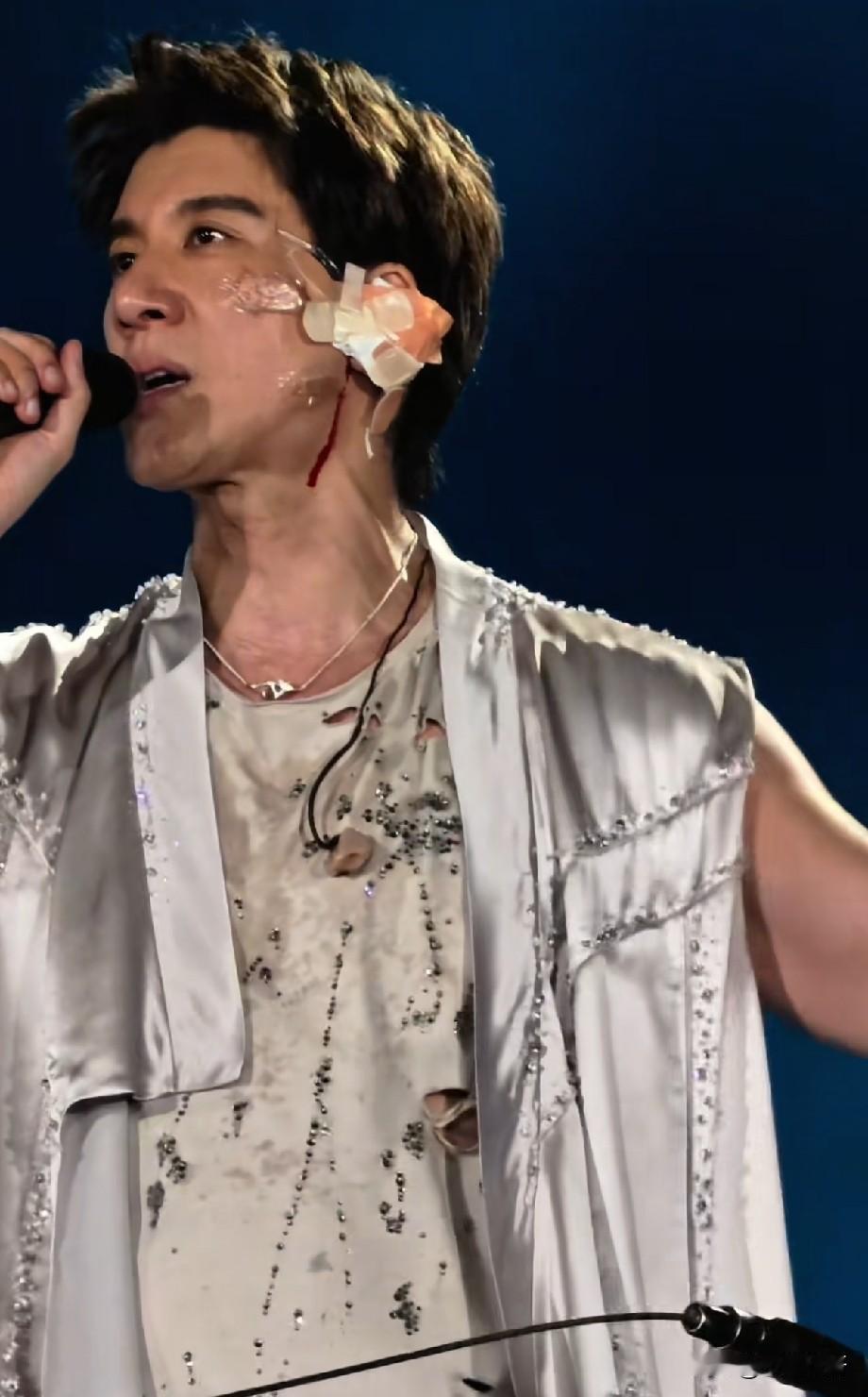 王力宏演唱会高空坠落受伤，面部缝合39针耳廓软骨碎裂，仍坚持完成剩余场次
 
7