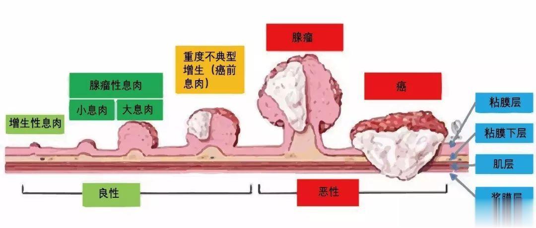 #全民营养提升计划##这个问题吃什么##全民慢病健康科普计划# 【这几类人都是肠