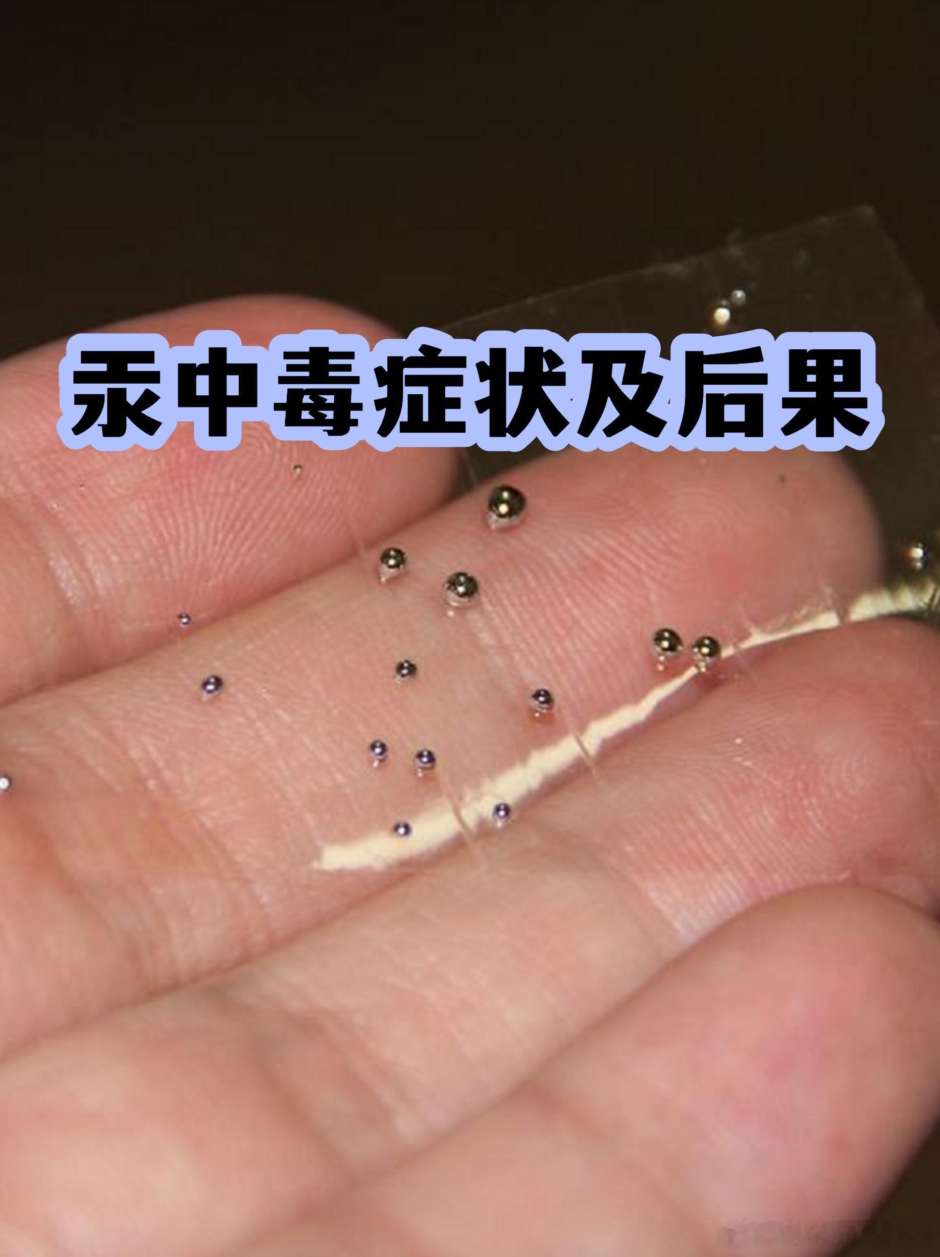 F女士真的中毒不浅 