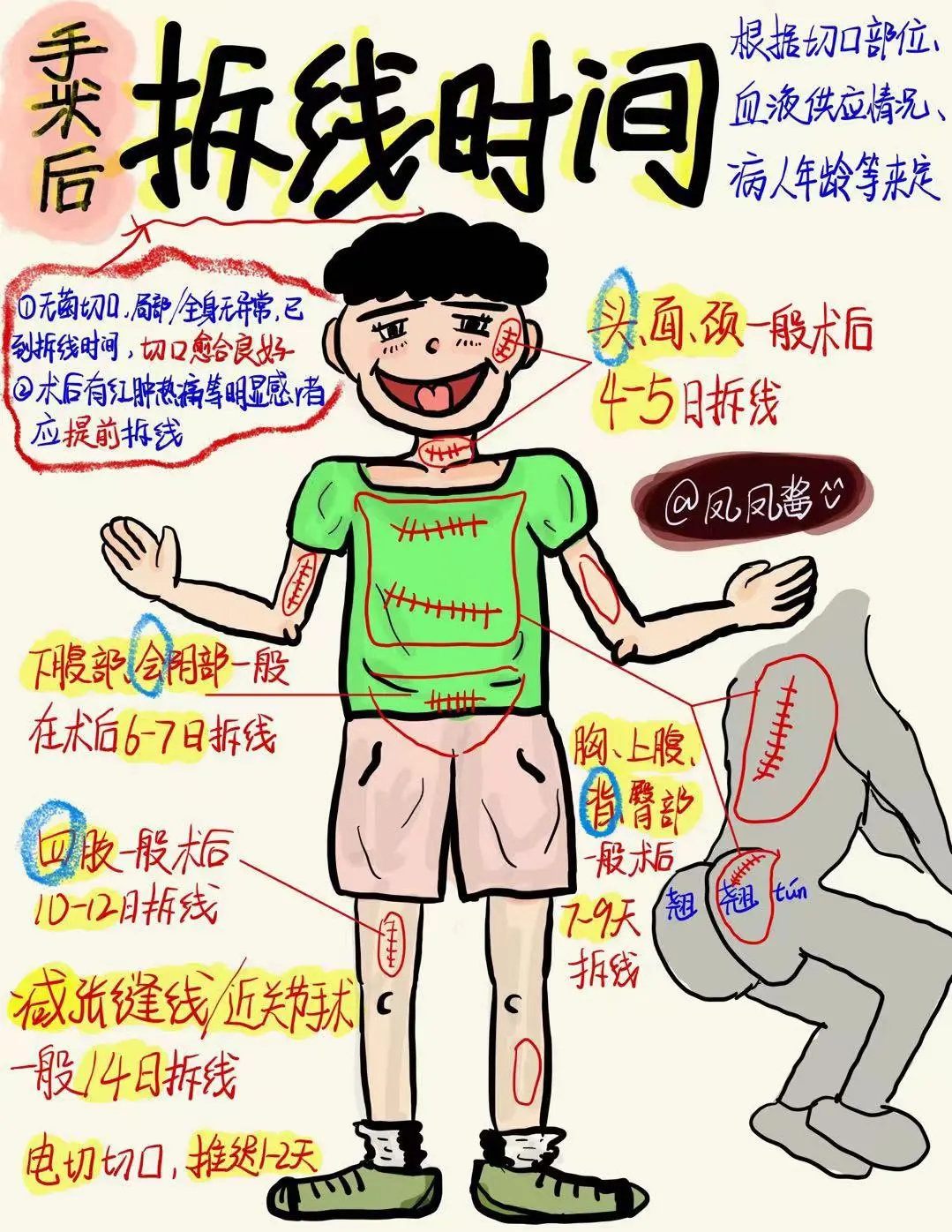 📚医学生笔记｜外科拆线时间 建议点赞收藏