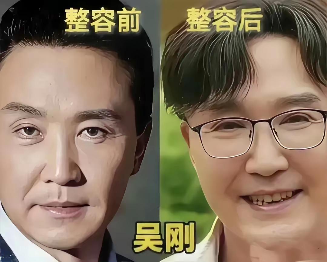 细数娱乐圈中整容失败的明星们，真的觉得好奇怪，明明有一张高颜值的脸，已经超越百分