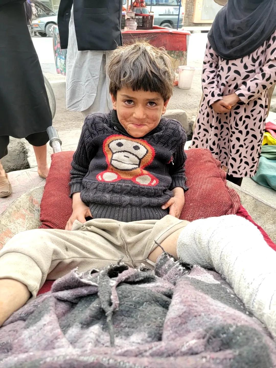 阿富汗石膏男孩
​我们看见他的时候，他就在小推车里。他父亲说家里的墙塌了，把男孩