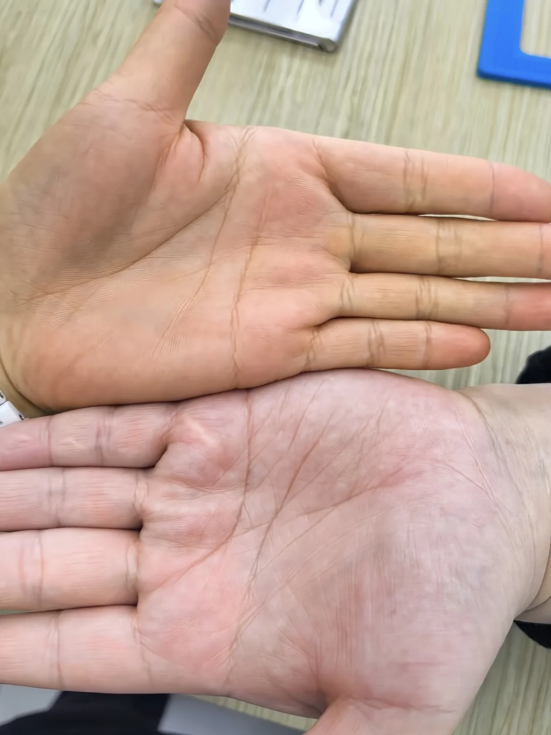 手掌黄到底是什么原因啊？