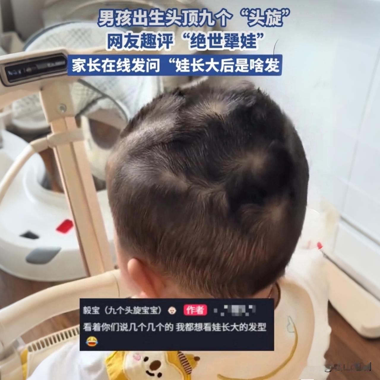 一旋精二旋楞？宝宝头旋的真相，很多父母都猜错了

你听说过吗？有的宝宝头上竟然长