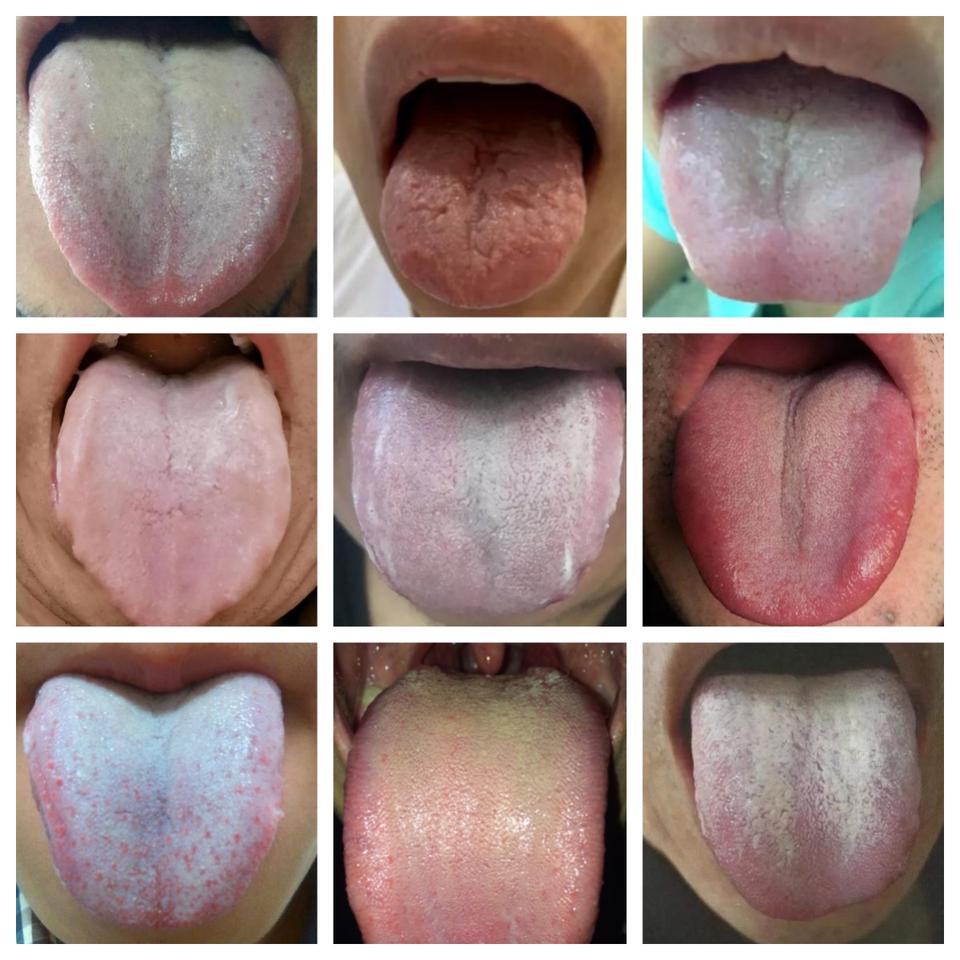 很多粉丝想让杨大夫，帮忙分析舌头，这肯定是可以的啦！
只要你发，马上分析！

注