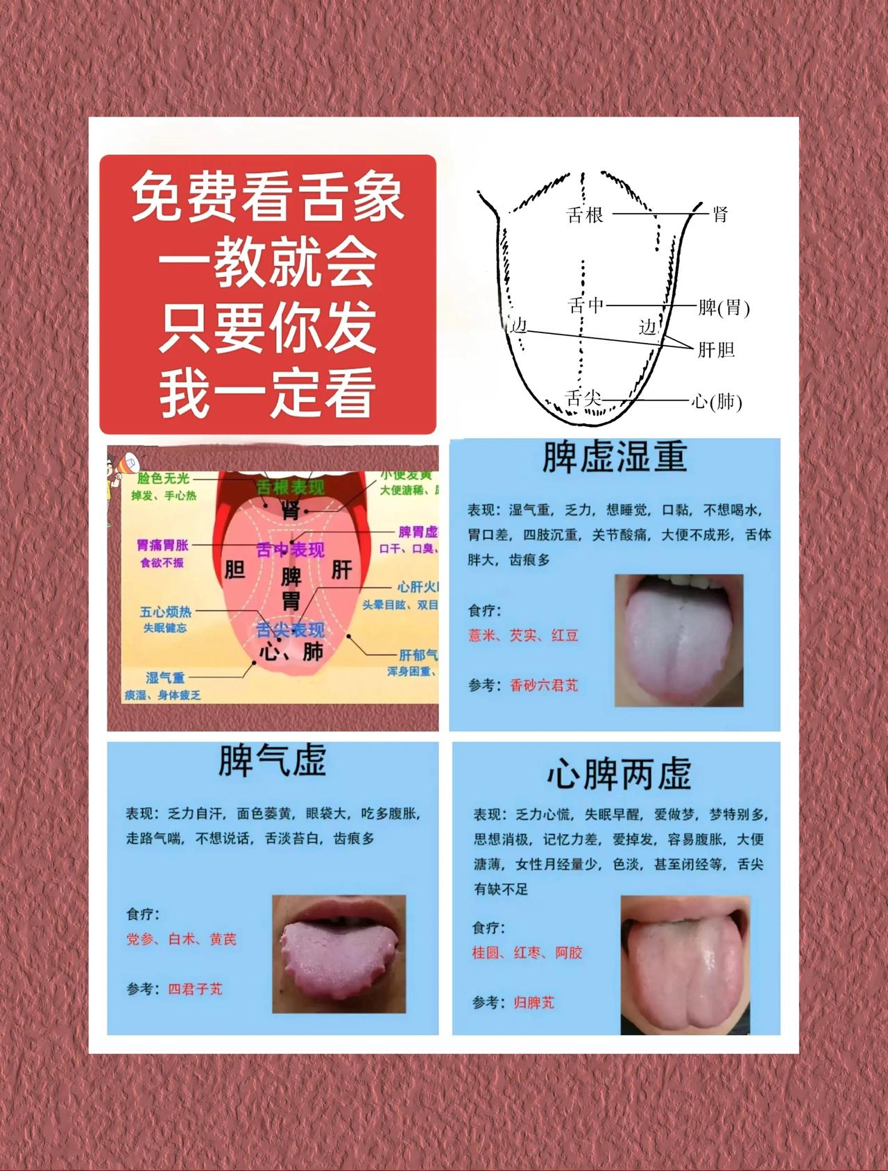 每日舌象：今天挑战看舌象100个，全程免费，免费，先发先看

大家早上好，今天挑