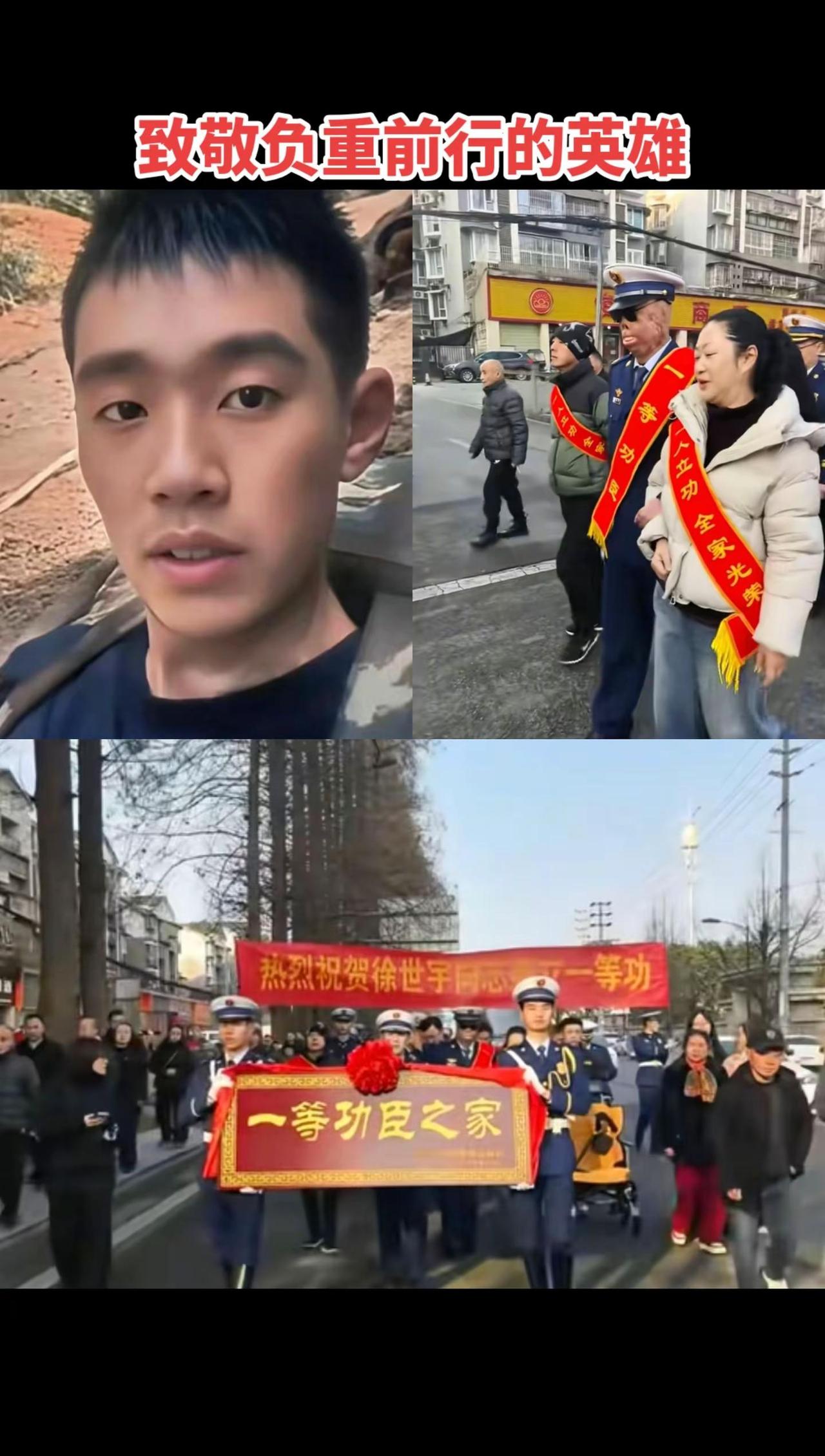 消防英雄徐世宇在救火任务中身负重伤、严重灼伤，那张被烈火灼伤的脸庞，让人看了无比