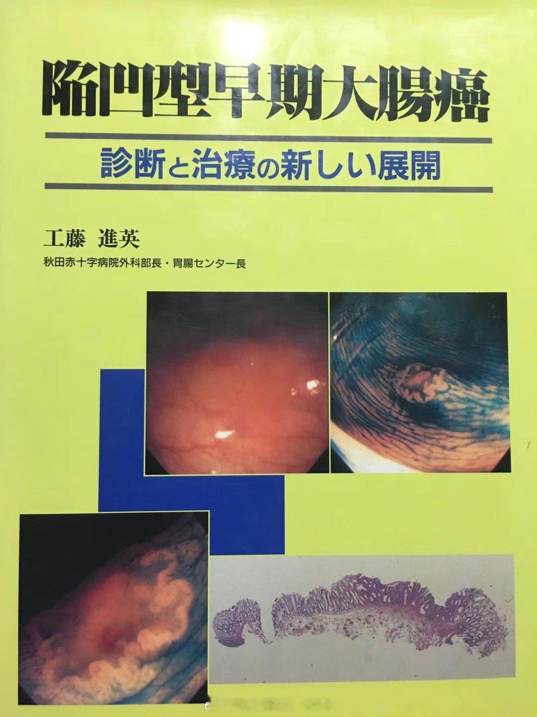 大部分人喜欢看新书，因为有结论可以直接拿来用，我比较喜欢看旧书，因为可以追本溯源