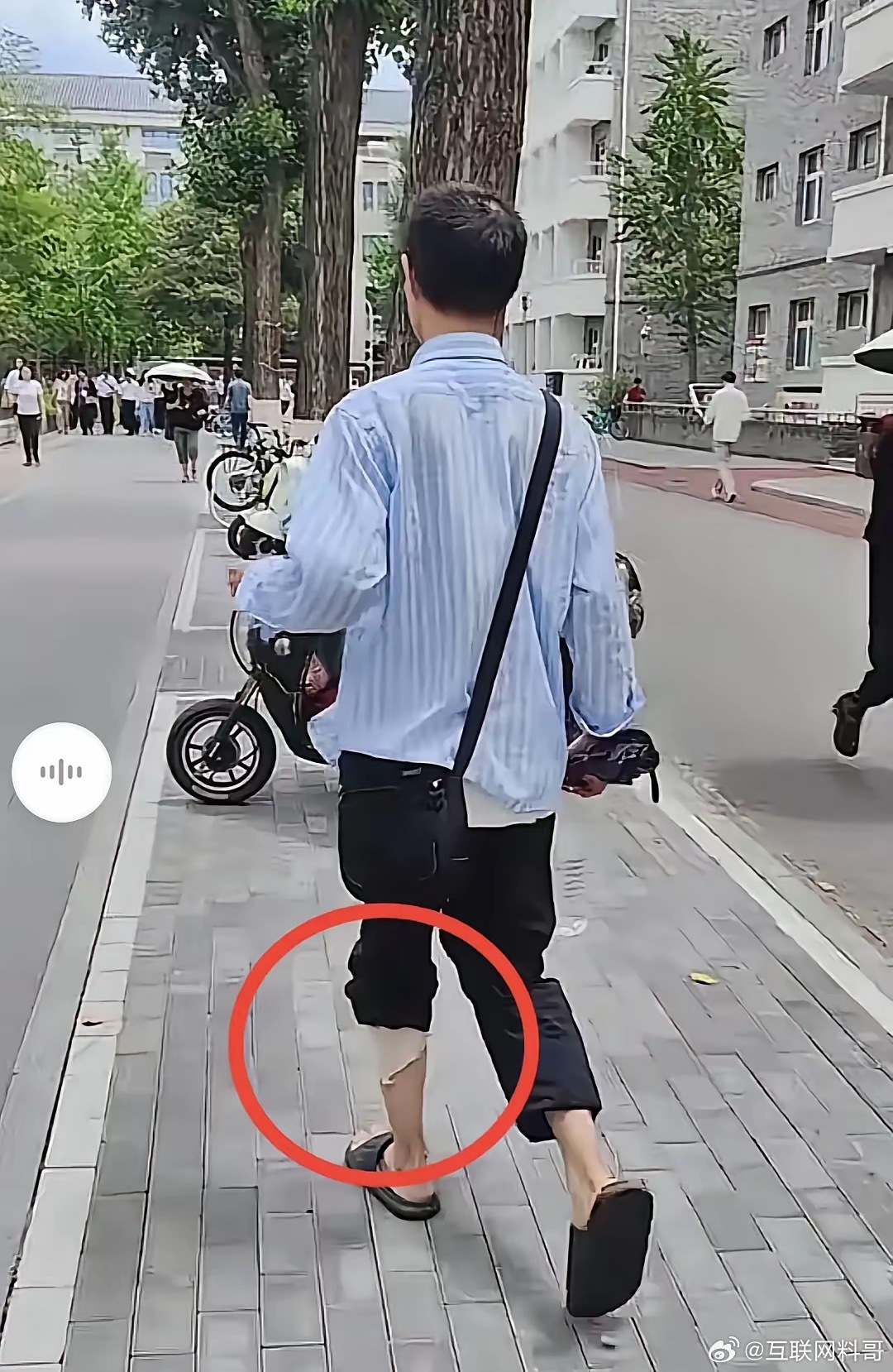 韦东奕啊，韦东奕，大夏天的，你居然还套着一条破破烂烂的秋裤出门，秋裤的下半截都破