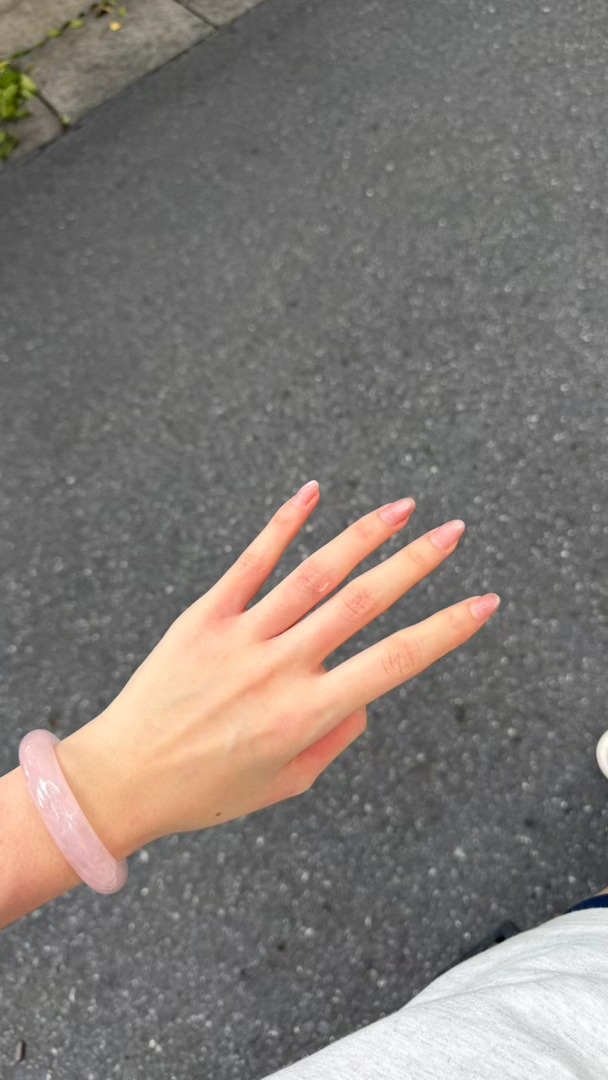 今天骑小电驴撞车了