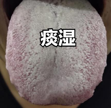 “三堵”不除，补药变毒！送你三个名方，清堵除瘀，彻底赶跑虚不受补

一堵：痰湿