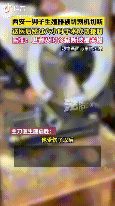 西安一42岁钢筋工生殖器被切割机切断，送医后经过六小时手术成功接回，医生称患者及