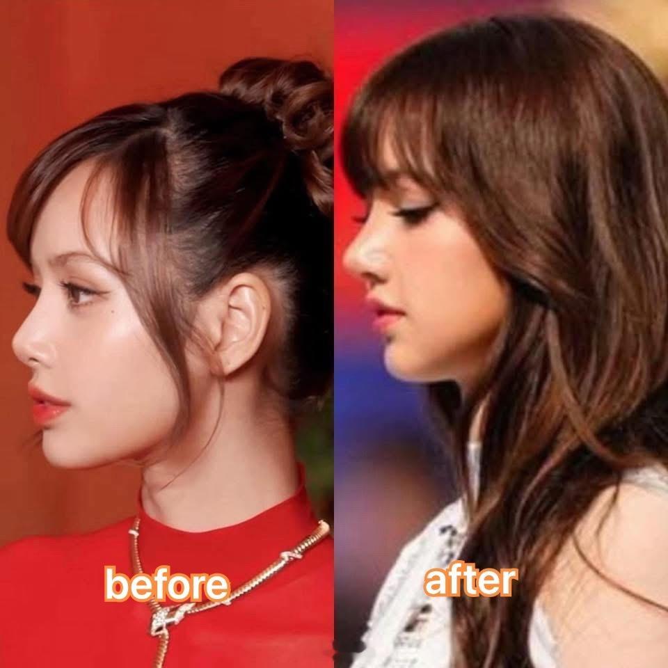 Lisa居然想不开去整鼻子了，你看看这好看吗？ 