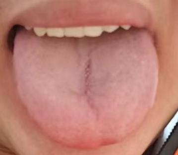 下焦问题反复难愈？切勿盲目进补，通补结合是根本







很多男同志上了年纪