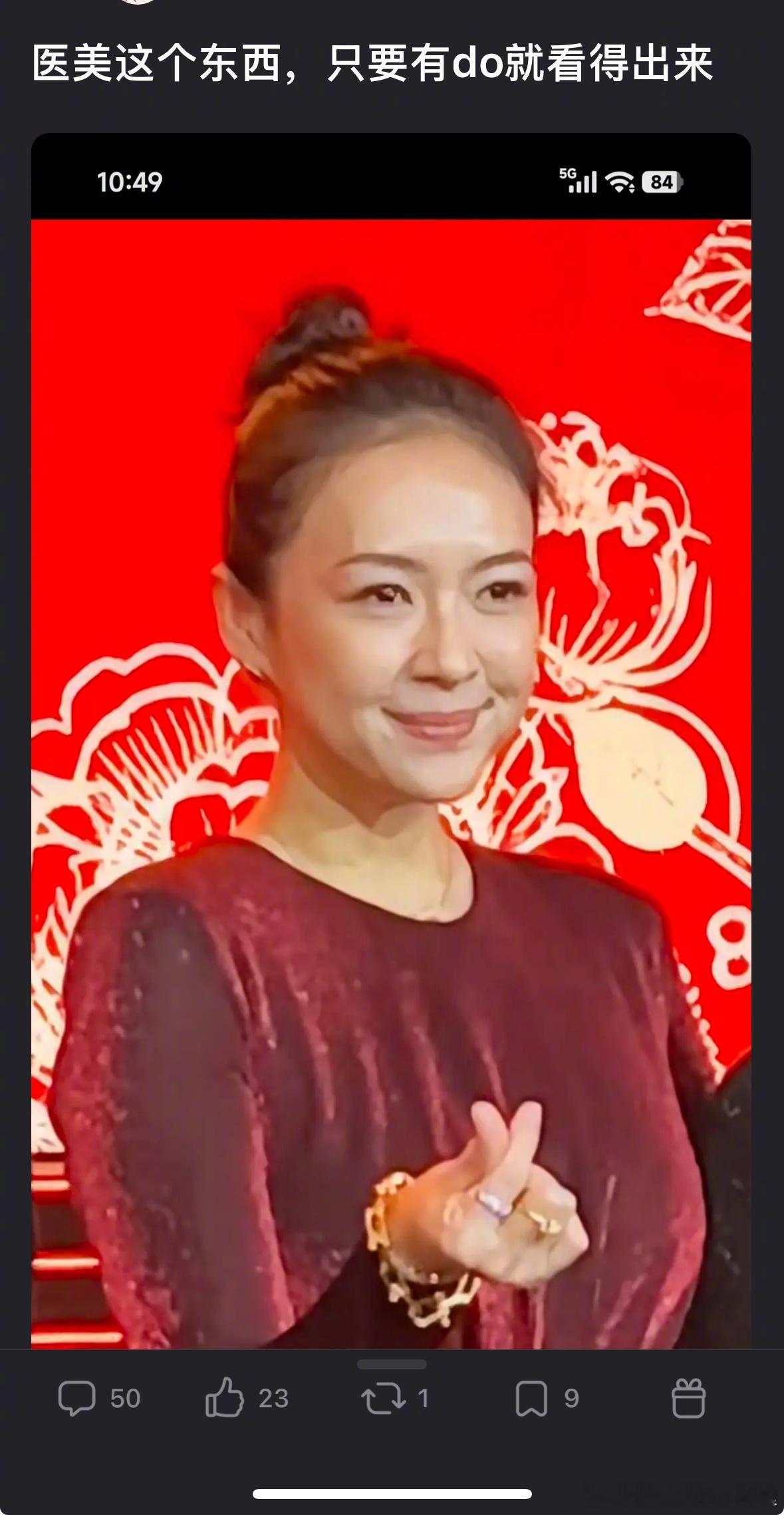 章子怡的脸能看出医美很急吗？ 