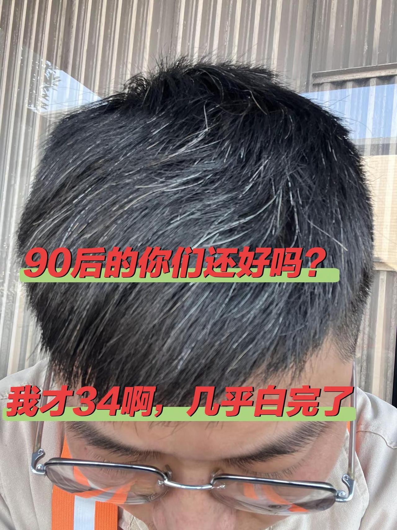 90后的你们，现在还好吗，我才34啊！满头白发了，