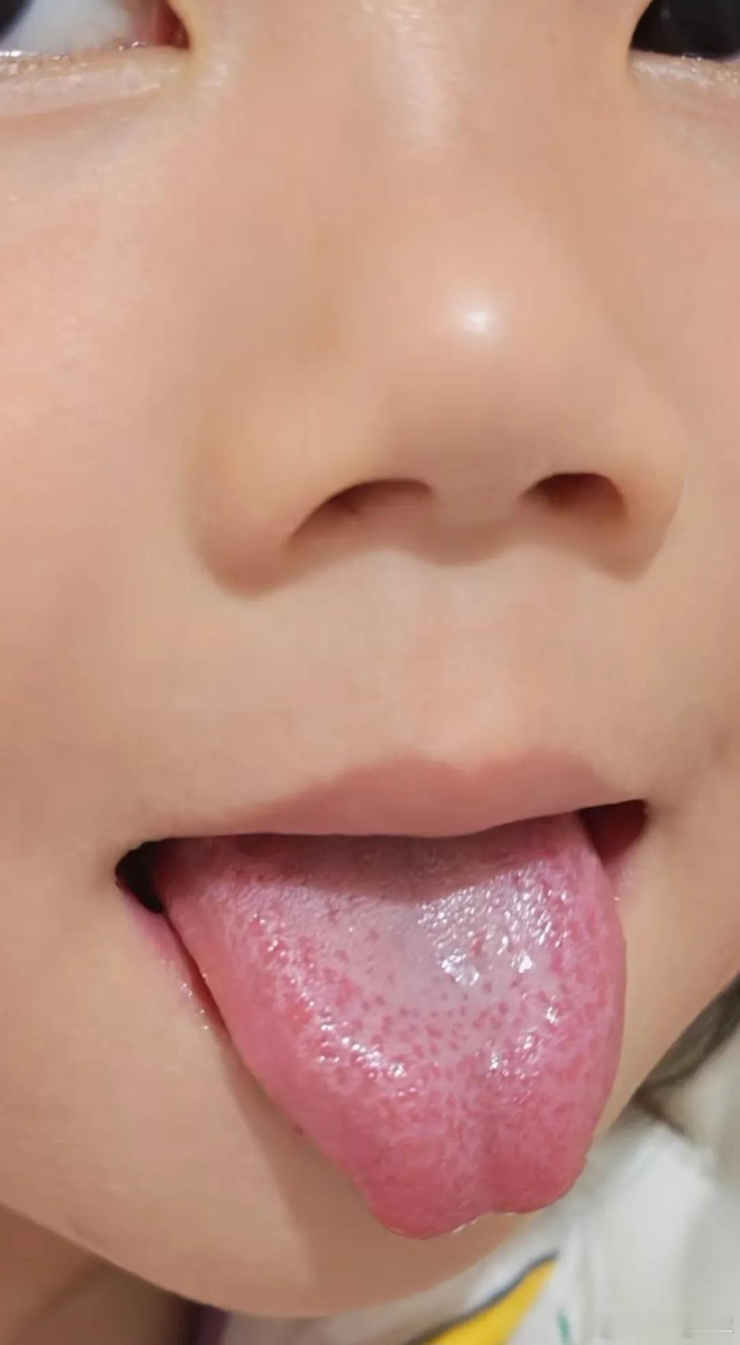 别乱治病！老中医一句点醒：病藏五脏、症露在外，看错一处全白治别再乱治病！老中医一