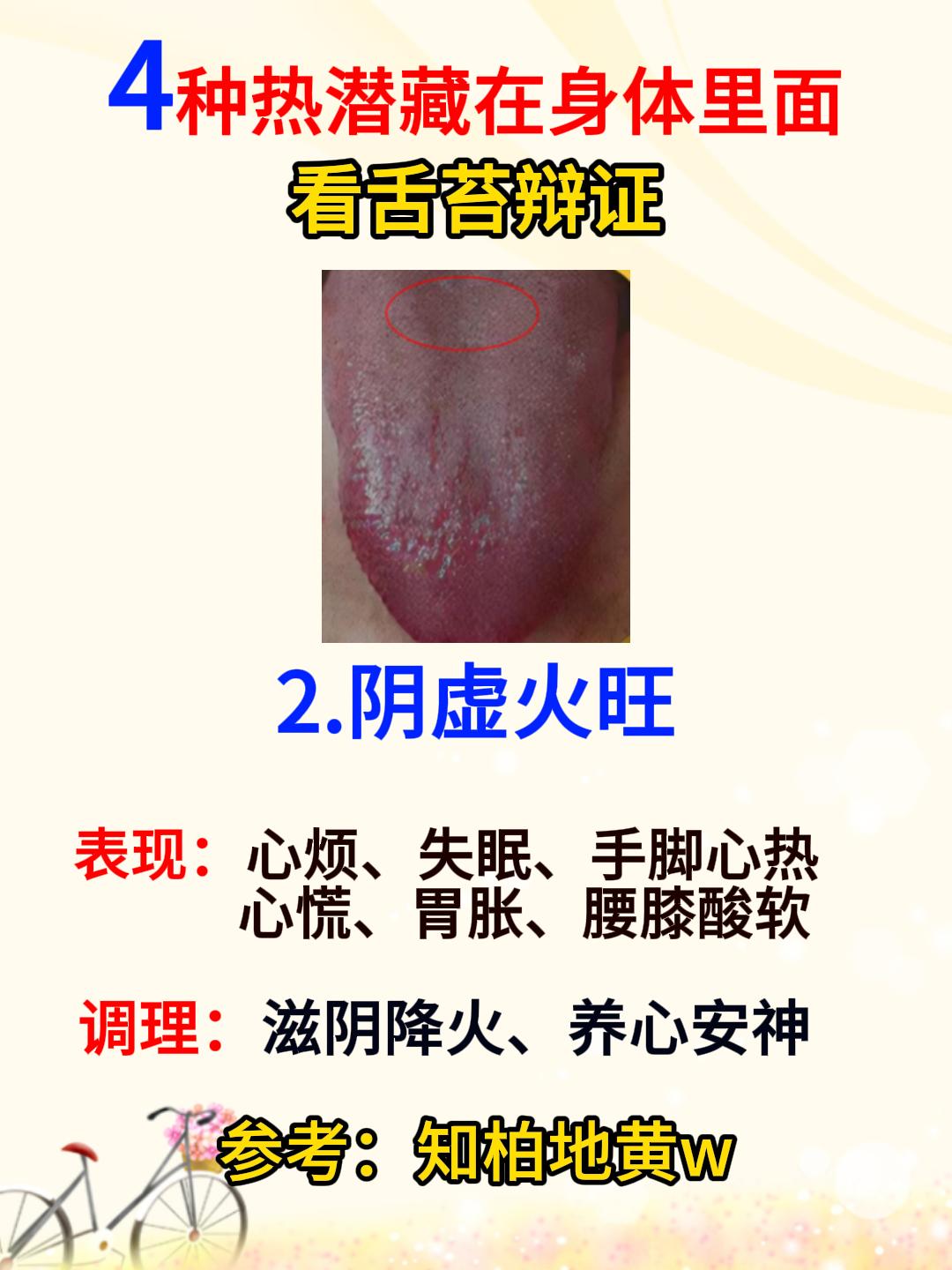 4种热潜藏在身体里面，对照看看，你是属于哪一种情况？[给力][给力][给力]