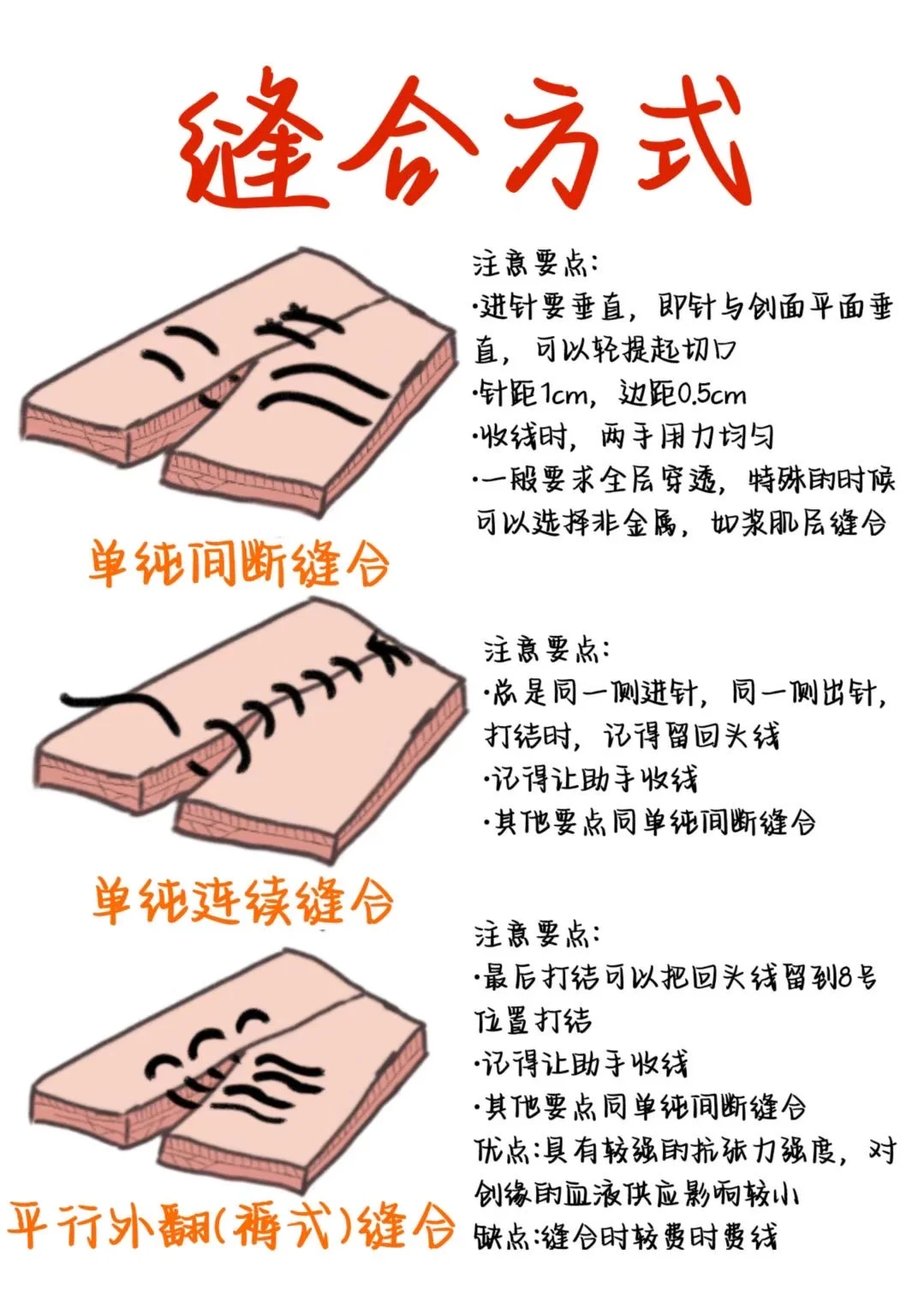 医学生笔记——缝合方式