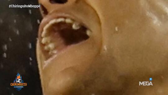 疼起来真要命，姆巴佩少了一颗前臼齿