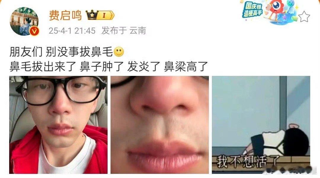 费启鸣别没事拔鼻毛这下真成小丑了哈哈哈🤡 ​​​