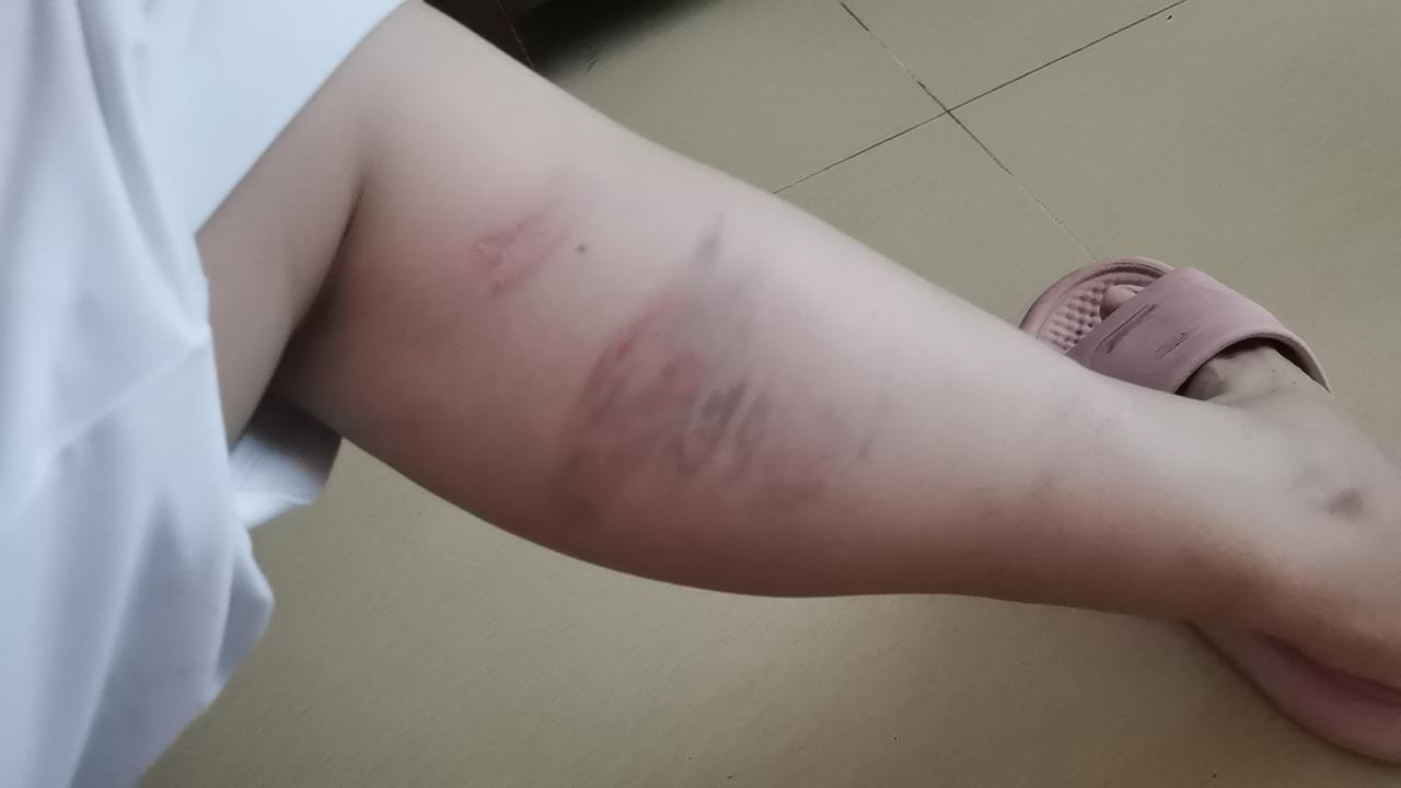 快六十岁的人了，今天早晨居然摔了一个超级无敌大跟头，我也是醉了。

今天七夕，起