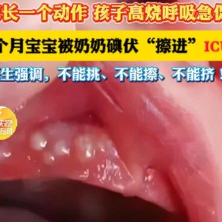 陕西西安一位宝妈发现家里2个月大的宝宝口腔里有异样，凑近一看，牙龈上长着几颗黄白