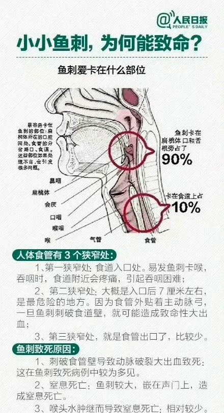 男子误吞5cm鱼刺用土方身亡 这么长的鱼刺。。。怕是比针还长了，怎么敢用吞饭啊[