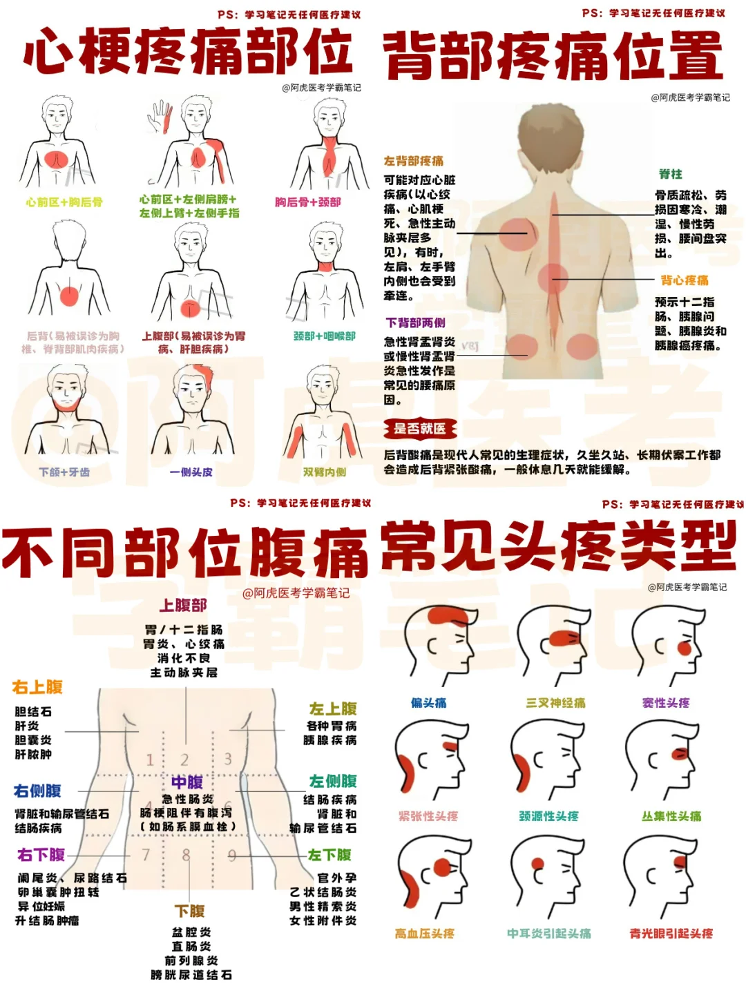 医学生笔记📒｜不同部位疼痛代表什么👆