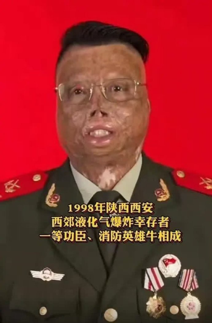 致敬消防英雄牛相成!舍身救人烧伤面积达97%，立一等功！ 